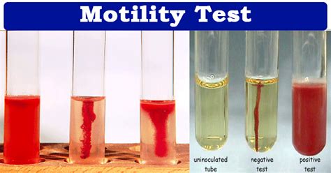 sugar permeability test|Techniques of Functional and Motility Test: How to Perform and .